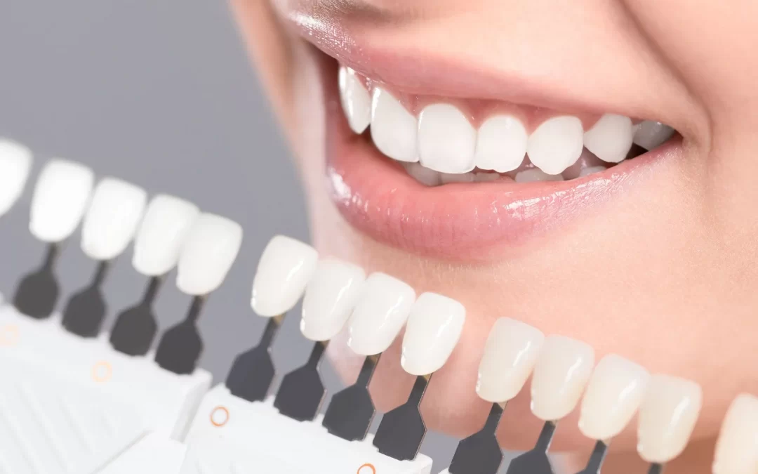 The Benefits Of Cosmetic Dentistry